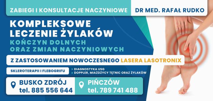 leczenie_zylakow_konczyn_dolnych_rafal_rudko_ulotka.jpg